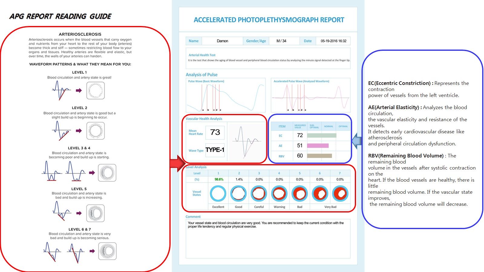 Cardiovascular Screening Device